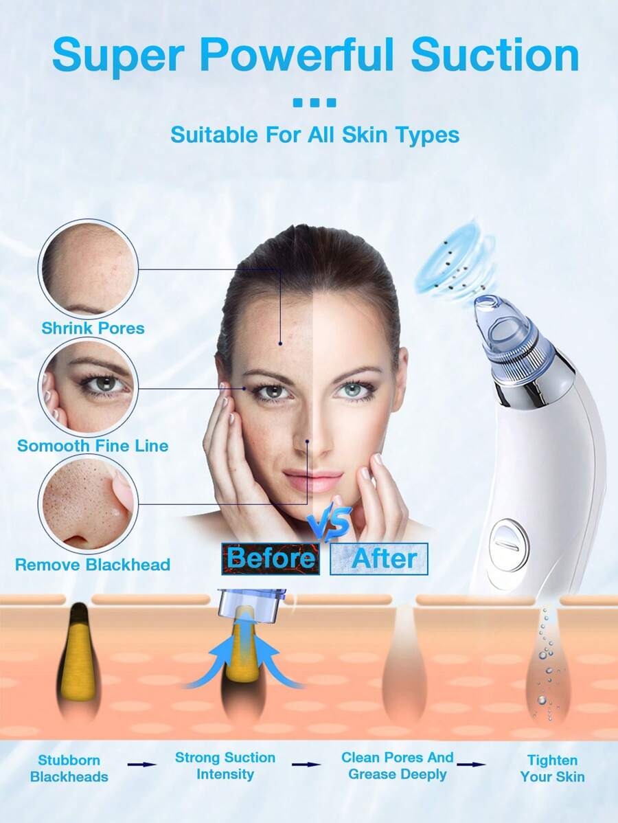 SHEIN GENAI جهاز شفط الرؤوس السوداء لون أبيض