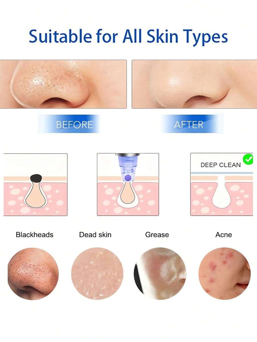 SHEIN GENAI جهاز شفط الرؤوس السوداء لون أبيض