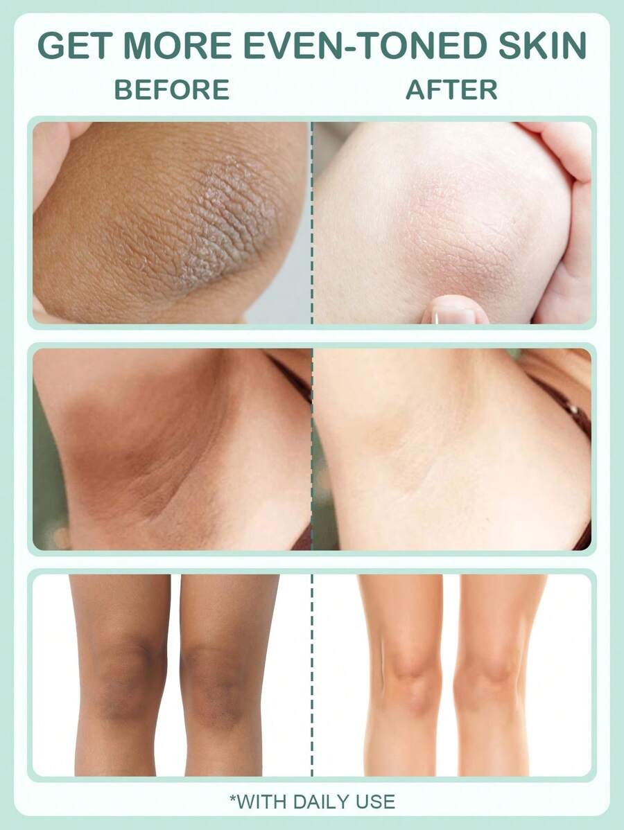 SHEIN SLOWSUNDAY Eكريم تفتيح الكولاجين من والنياسيناميد وفيتامين