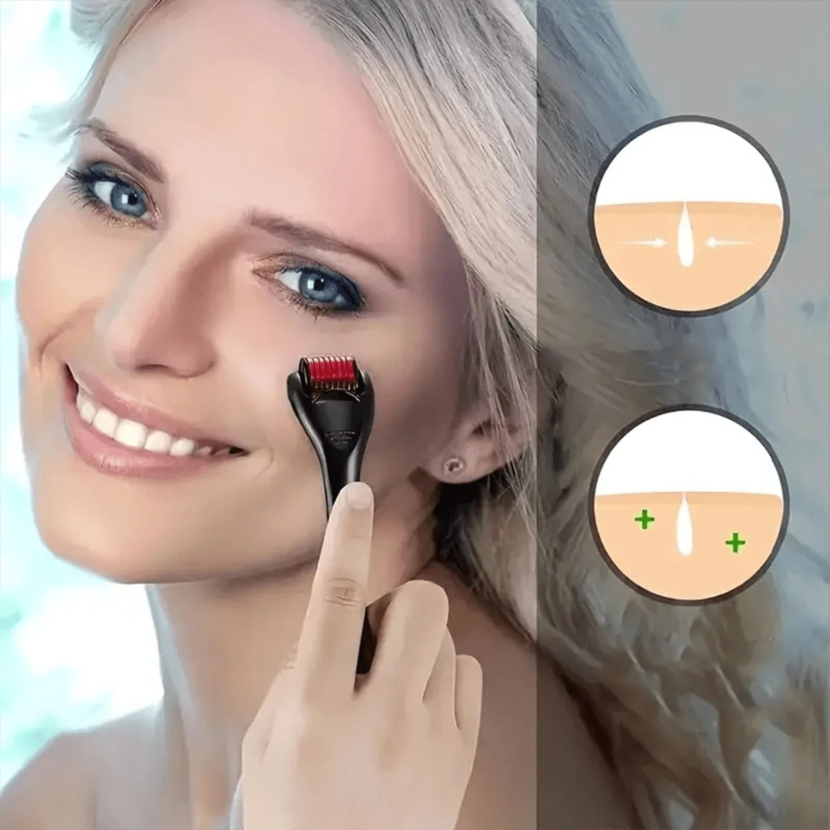 SHEIN LUJITO أداة تقشير البشرة 540 إبرة دقيقة