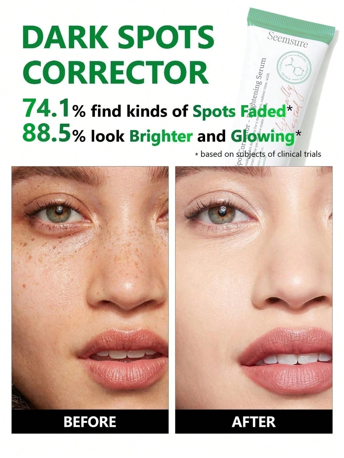 SHEIN seemsure معالج نقاط السواد لتفتيح وترطيب البشرة